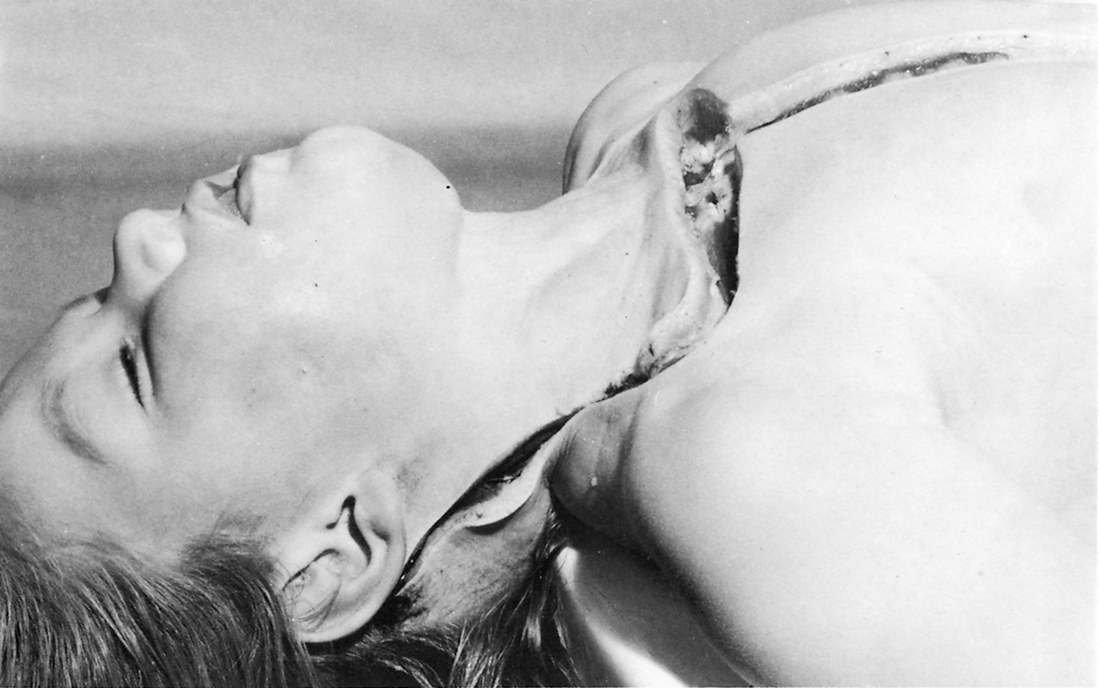 Maurice Blaussyld Maurice Blaussyld